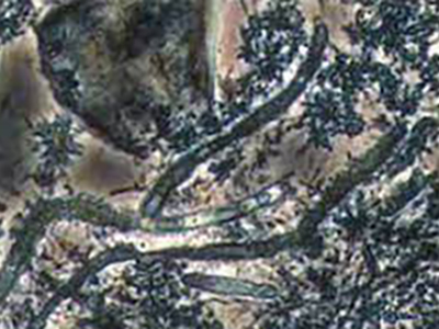 “カンジダアルビカンス（カビ菌）