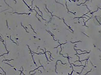 スピロヘータ（歯周病菌）