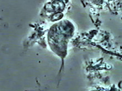 口腔トリコモナス（原虫）